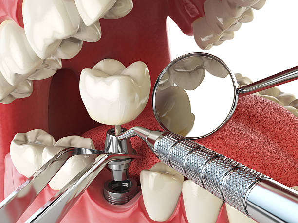 Best Emergency Tooth Extraction in Ludowici, GA